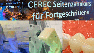 Cerec Seitenzahnkurs für Fortgeschrittene